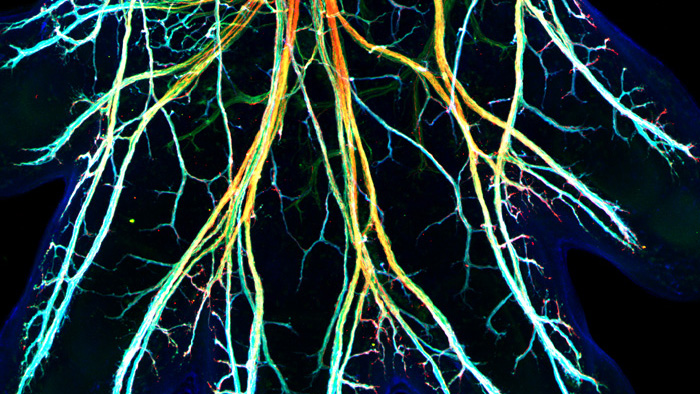 datorgenererad bild av nervceller.
